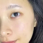 Trang chủ 44 Review Neutidi trị mụn từ chị khách hàng