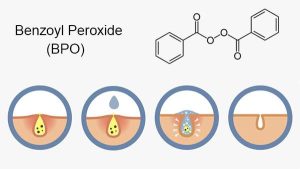 Benzoyl Peroxide