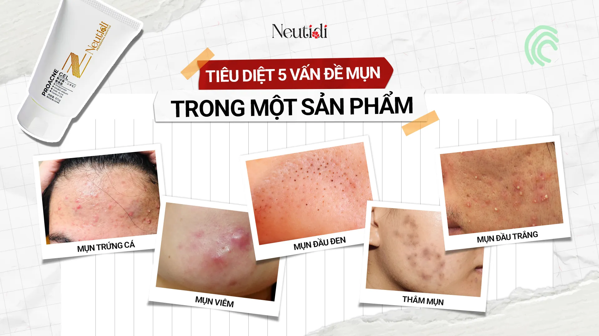 Tiêu diệt 5 vấn đề mụn trong một sản phẩm