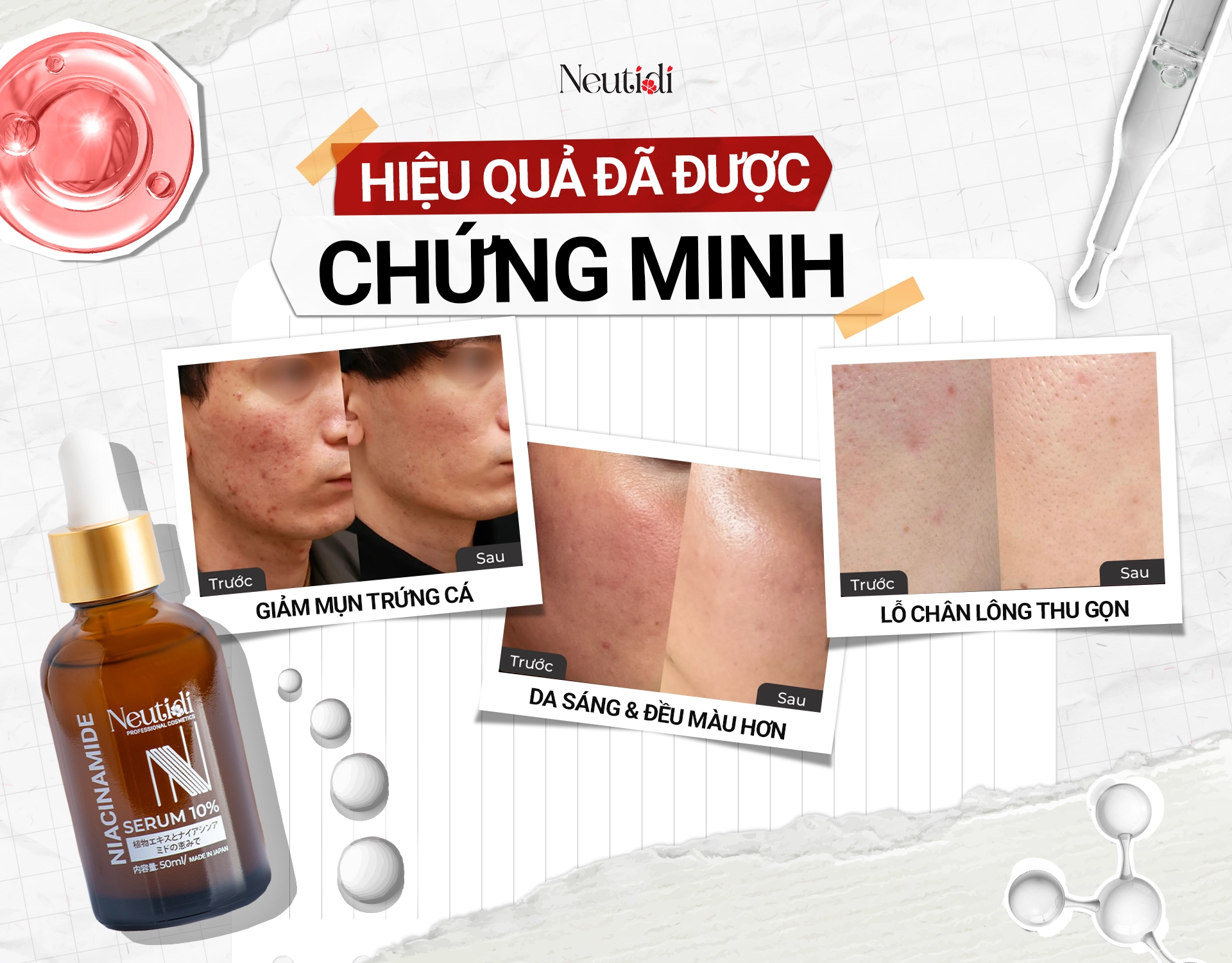 Review serum Niacinamide 10% từ Neutidi: Có hiệu quả hay không?