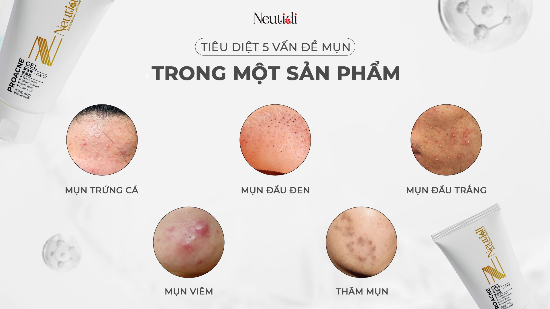 Gel dưỡng ẩm, ngừa mụn Neutidi ProAcne Gel 11 Neutidi ProAcne Gel - hỗ trợ giảm các loại mụn trứng cá, mụn đầu đen, đầu trắng, mụn viêm, mụn thâm