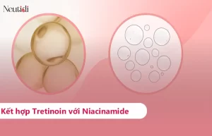 Cách dùng kết hợp Niacinamide với Tretinoin hiệu quả đúng cách