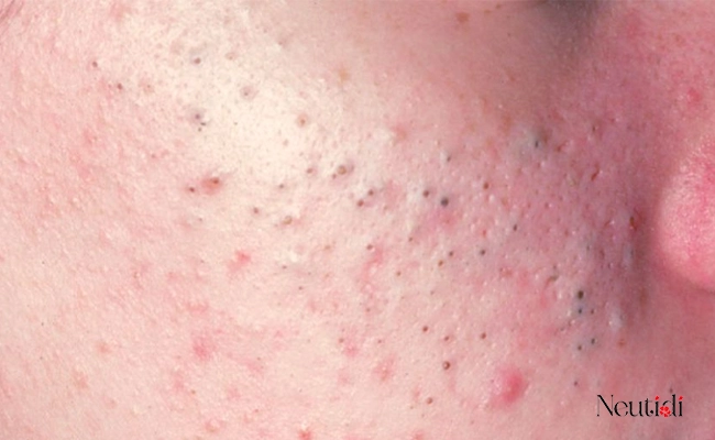 Serum gây nóng rát mặt do tình trạng da của bạn