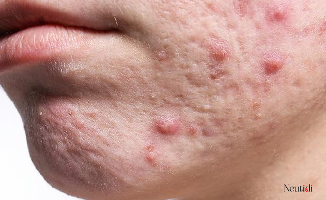 Hướng Dẫn Cách Sử Dụng Serum Hiệu Quả Cho Da Khỏe Đẹp 2 Khi nào nên sử dụng serum?