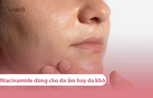 niacinamide dung cho da am hay da kho