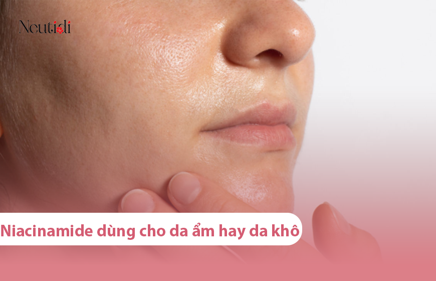 niacinamide dung cho da am hay da kho