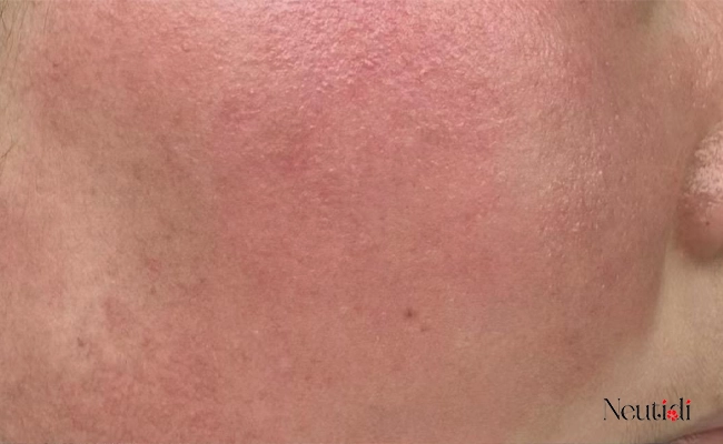 Serum B3 hỗ trợ phục hồi da tổn thương