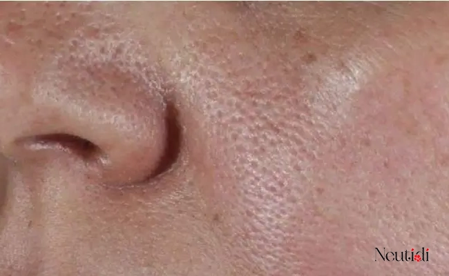 Các loại da phù hợp với serum B6