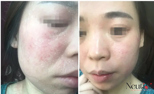 Dấu hiệu cho thấy serum đang phát huy hiệu quả