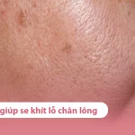 Serum giúp se khít lỗ chân lông hiệu quả
