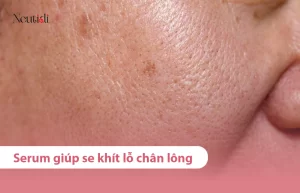 Serum giúp se khít lỗ chân lông hiệu quả