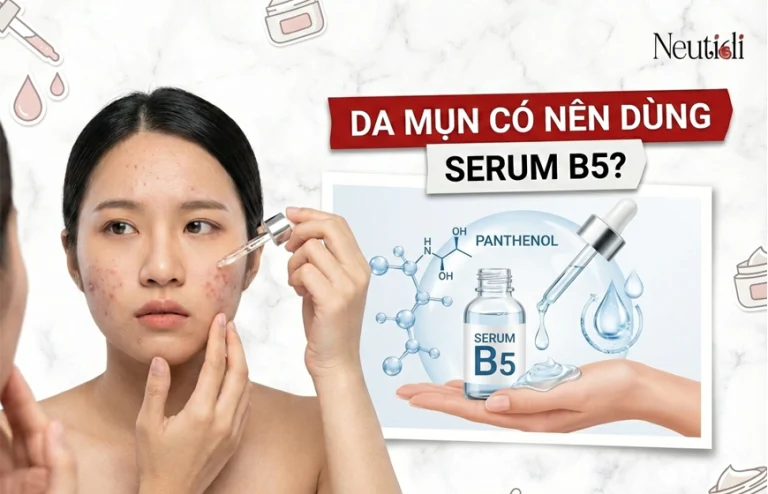 Da mụn có nên dùng serum B5