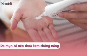 Có nên thoa kem chống nắng cho da mụn?