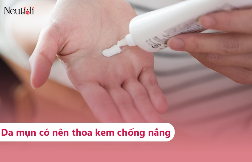 Có nên thoa kem chống nắng cho da mụn?