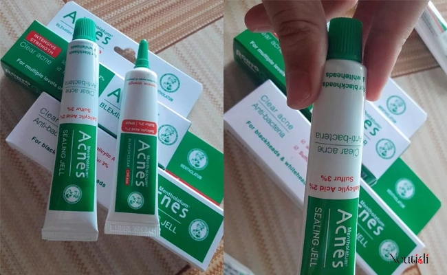 Gel acnes trị mụn có hiệu quả không