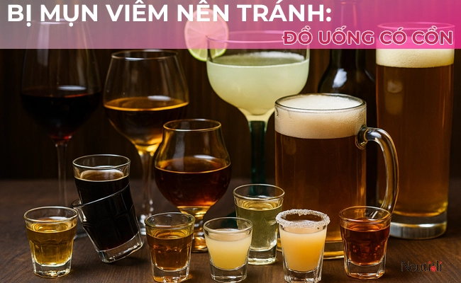 Cần tránh rượu bia, đồ uống có cồn khi bị mụn viêm
