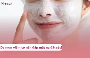Mụn viêm có nên đắp mặt nạ đất sét hay không?