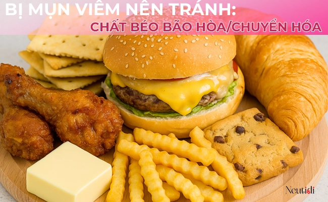Nên tránh đồ ăn chứa nhiều chất béo có hại đối với người bị mụn viêm
