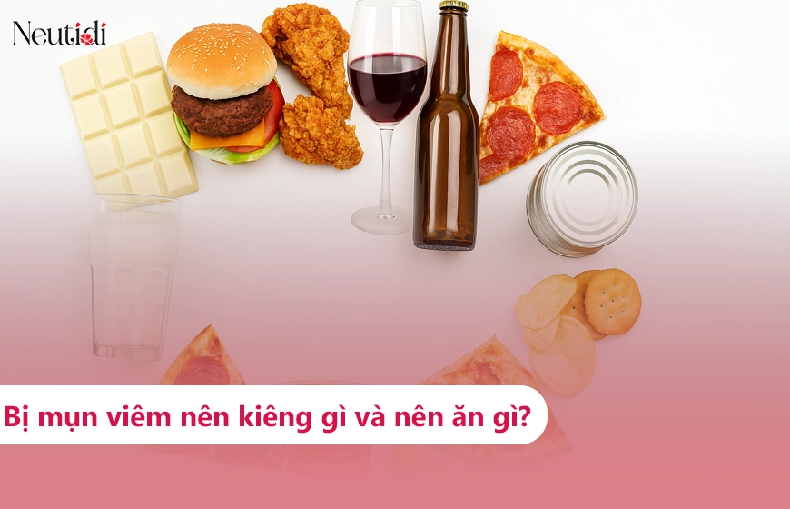 Người bị mụn viêm nên kiêng ăn gì? Tìm hiểu ngay