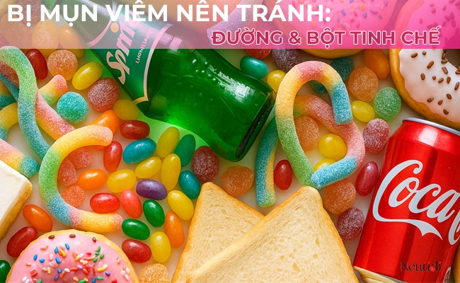 Bị mụn viêm nên kiêng ăn gì? 7 nhóm thực phẩm cần hết sức lưu ý 2 Người bị mụn viêm nên kiêng ăn đồ ăn nhiều đường, tinh bột tinh chế