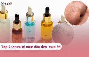 Review 5 serum trị mụn đầu đen và mụn ẩn đáng dùng, hiệu quả nhất 2025