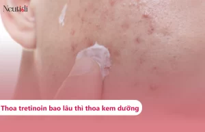 Bôi tretinoin sau bao lâu thì thoa kem dưỡng ẩm?