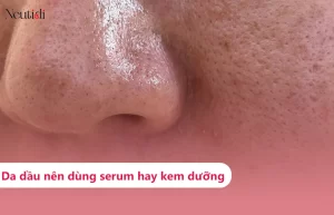 Da dầu nên dùng serum hay kem dưỡng