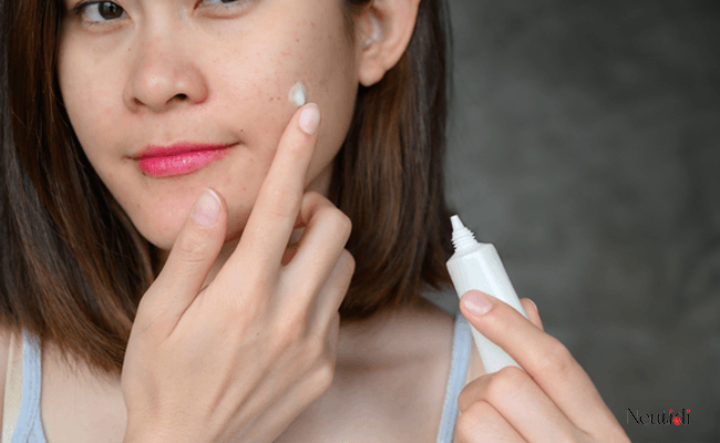 Da mụn có cần bôi dưỡng ẩm, cấp ẩm không?