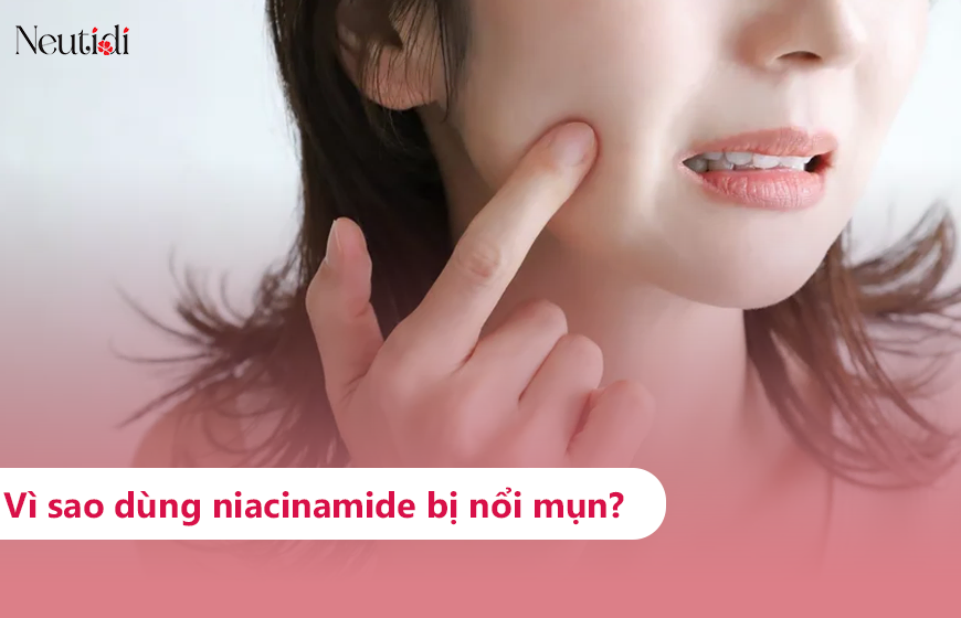 Tìm hiểu về tình trạng dùng niacinamide bị lên mụn
