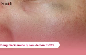 Dùng niacinamide bị thâm sạm da