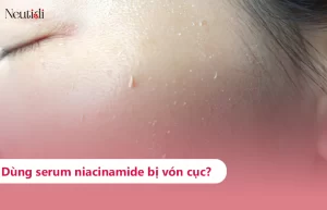 Dùng niacinamide bị vón cục