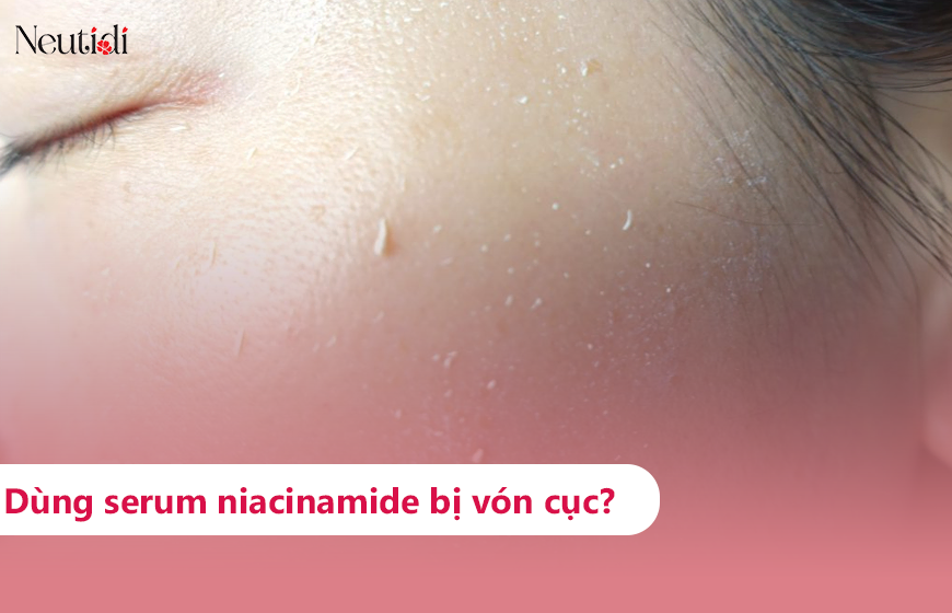 Dùng niacinamide bị vón cục