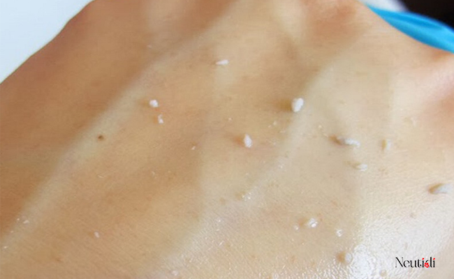 Nguyên nhân khiến bôi niacinamide bị vón cục