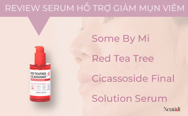 Serum Some By Mi trị mụn viêm có tốt không?