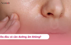 Da dầu có cần dùng kem dưỡng ẩm nữa hay không?
