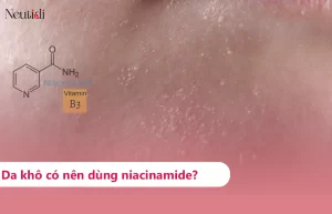 Da khô có nên dùng niacinamide