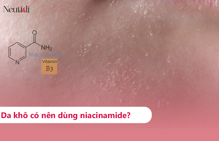 Da khô có nên dùng niacinamide