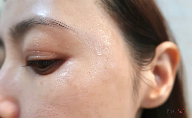 Lưu ý khi dùng serum trắng da mờ thâm