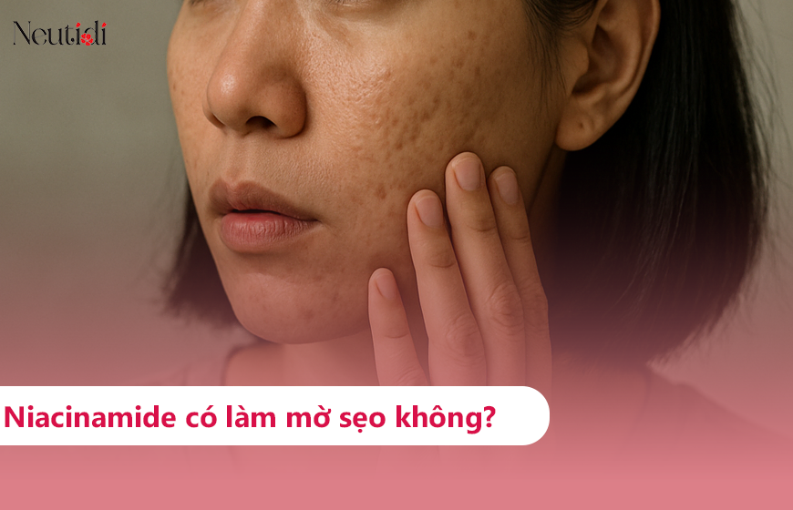 Niacinamide có tác dụng làm mờ sẹo không?