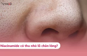 Tìm hiểu về khả năng thu nhỏ lỗ chân lông của niacinamide