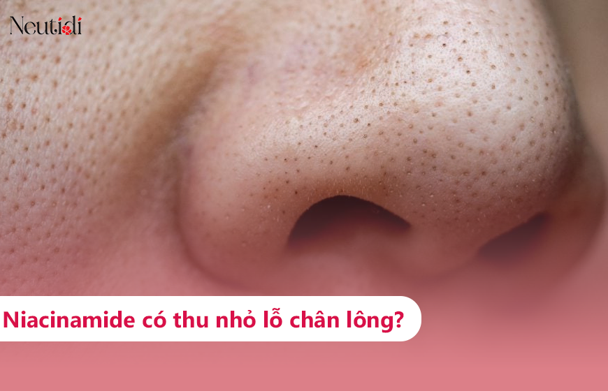 Tìm hiểu về khả năng thu nhỏ lỗ chân lông của niacinamide
