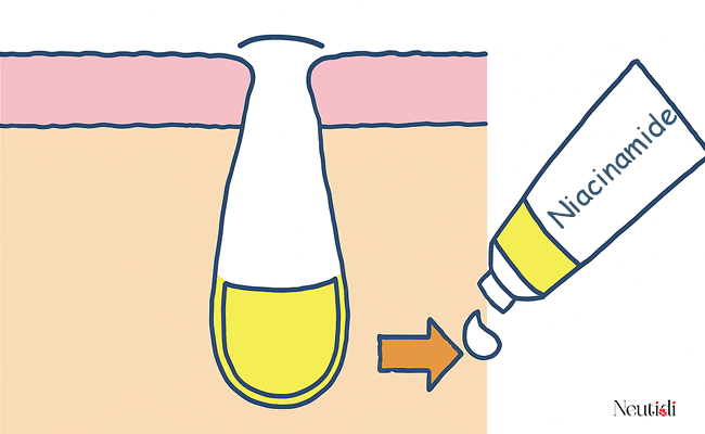 Cách niacinamide tác động đến lỗ chân lông
