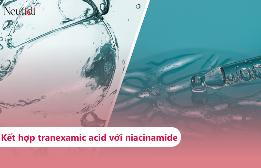 Kết hợp niacinamide với tranexamic acid