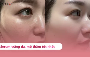 TOP 10 serum trắng da mờ thâm hiệu quả nhất