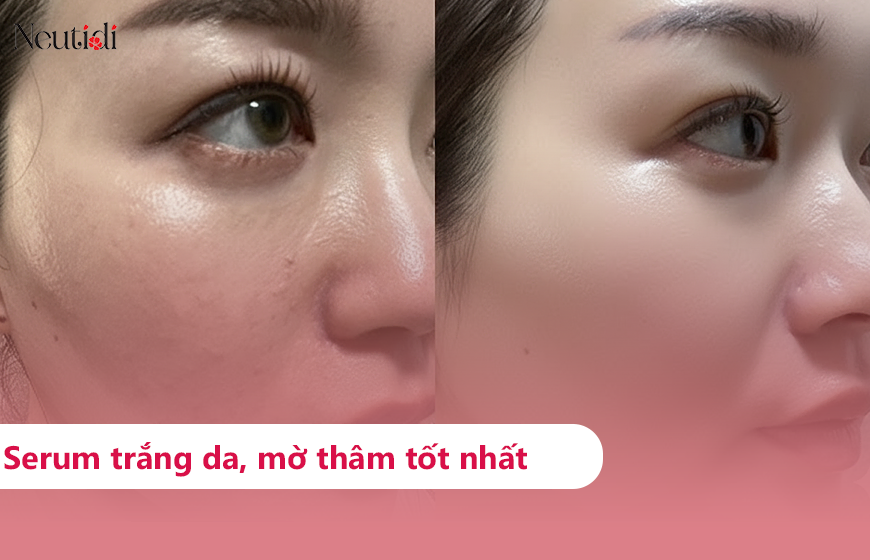 TOP 10 serum trắng da mờ thâm hiệu quả nhất