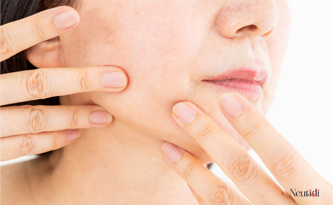 Top 7 kem dưỡng da chống lão hóa nên dùng cho phụ nữ tuổi 40 2 Dấu hiệu da lão hóa ở tuổi 40