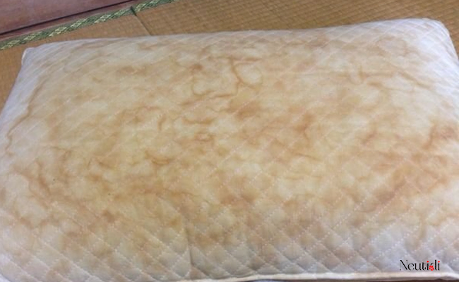 Vỏ gối, đồ dùng sinh hoạt bẩn có thể gây mụn