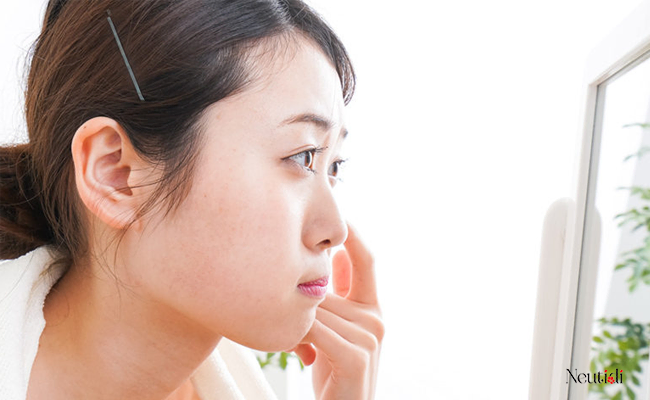 Những nguyên nhân gây hình thành mụn
