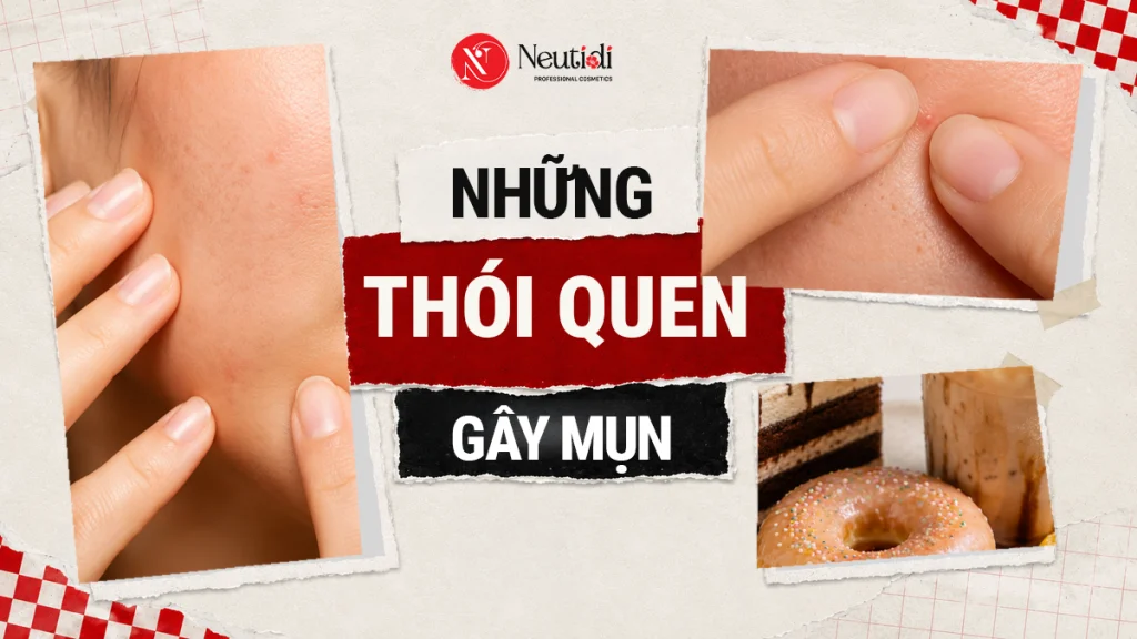 Bạn đã biết 10 thói quen dễ gây nổi mụn trứng cá? 1 Những thói quen gây mụn trứng cá