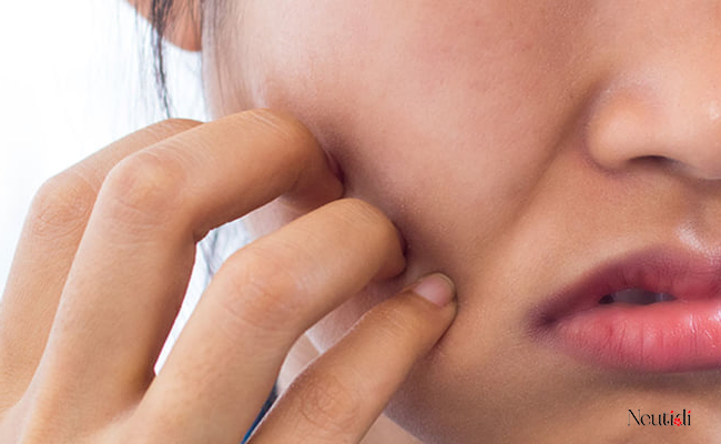 Rát da do dùng sữa rửa mặt không phù hợp